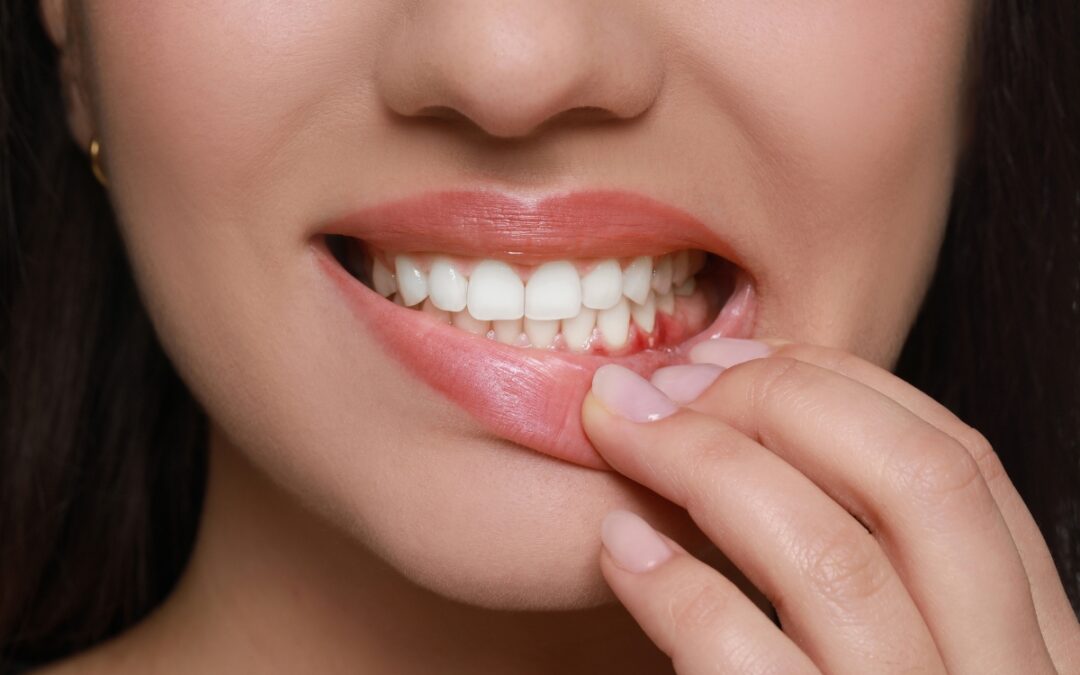 How Gum Disease Can Lead to Tooth Loss