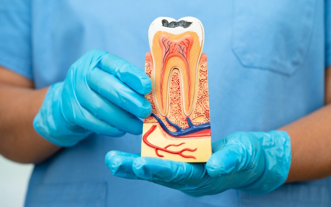 Root Canal Therapy Can Help Prevent Further Oral Infection