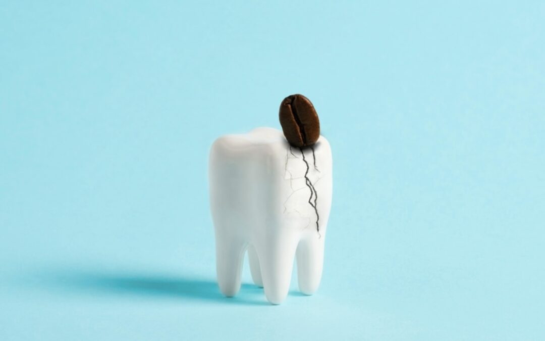 Chipped Tooth? Here’s How Your Dentist Can Fix It