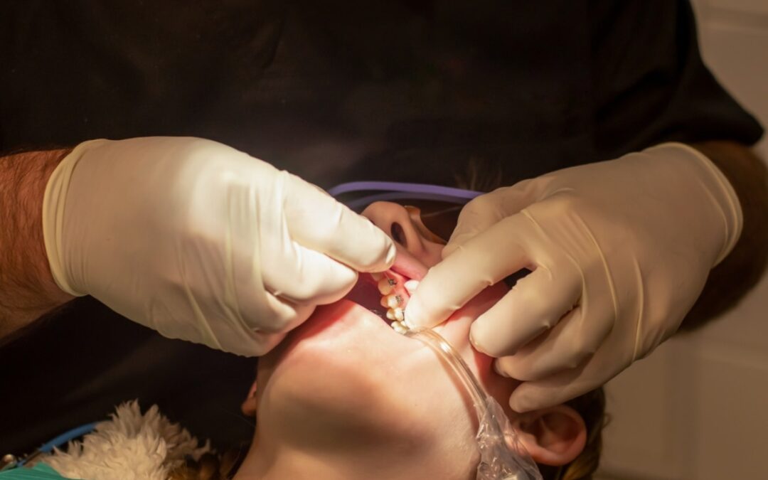 Why Choosing an Orthodontist is Key for Your Smile Development
