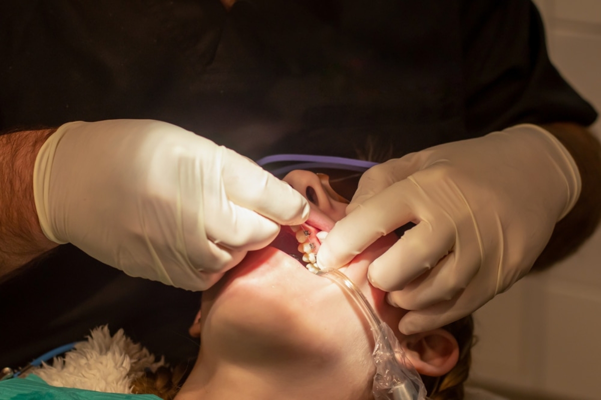 Orthodontic Treatment Pflugerville