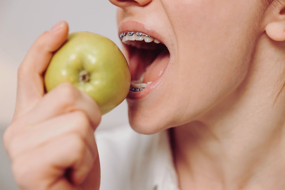 Women with braces on teeth eating green apple