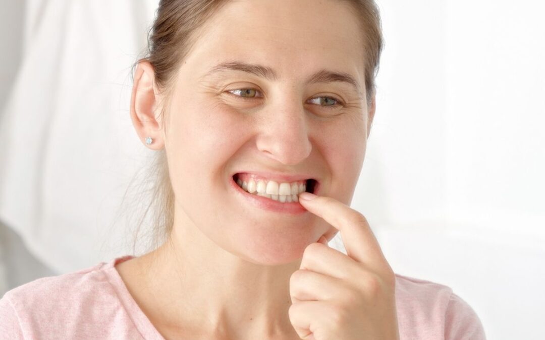 Is It Normal for Gums to Bleed Sometimes?