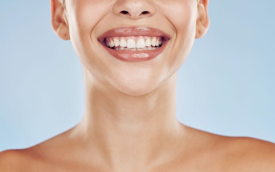 Chalky Teeth Solutions: Are Dental Veneers the Best Option?