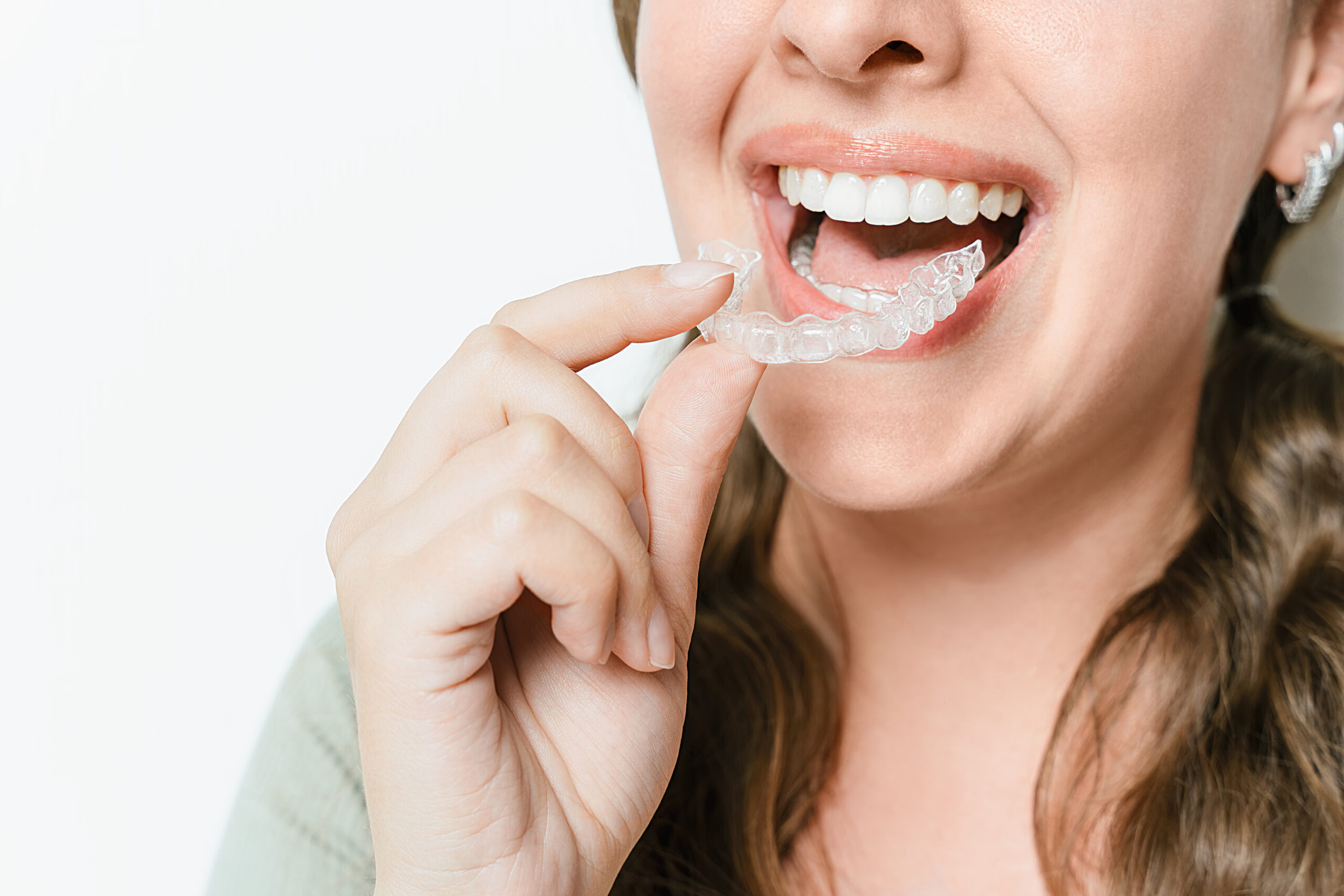 Woman placing a clear aligner tray onto her teeth, demonstrating daily Invisalign oral hygiene routine