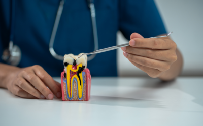 Can a Tooth Infection Spread If You Don’t Get a Root Canal?