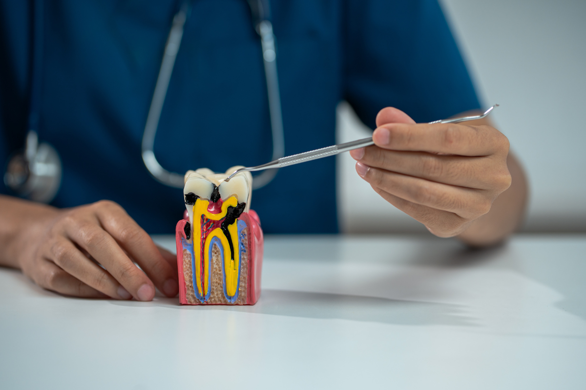 root canal therapy in Pflugerville