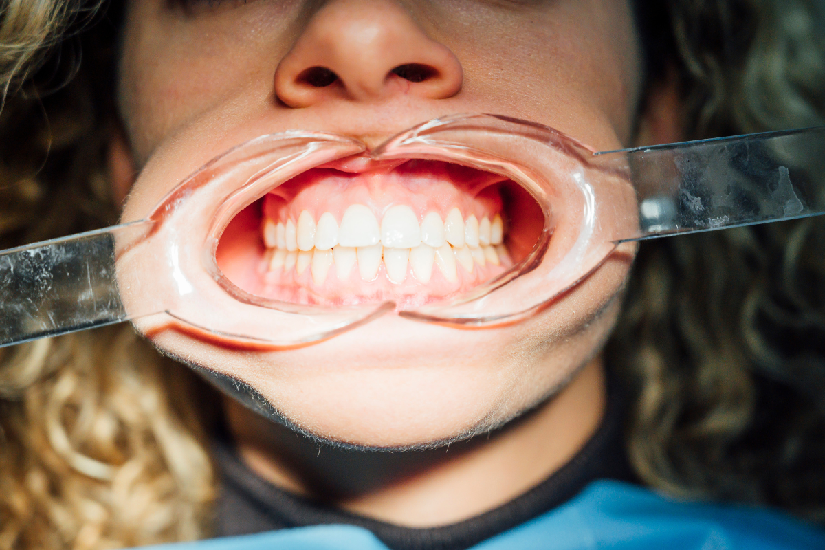 gum disease treatment gum disease treatment